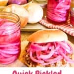 Pickled onions in jars and on a sandwich.